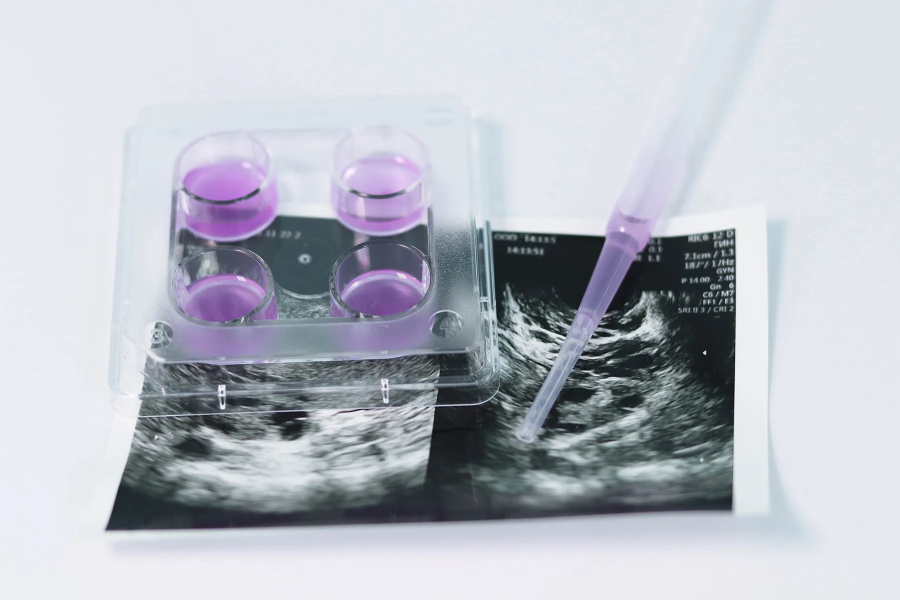 plate for cultivation of embryos in the IVF program amid an ultrasound